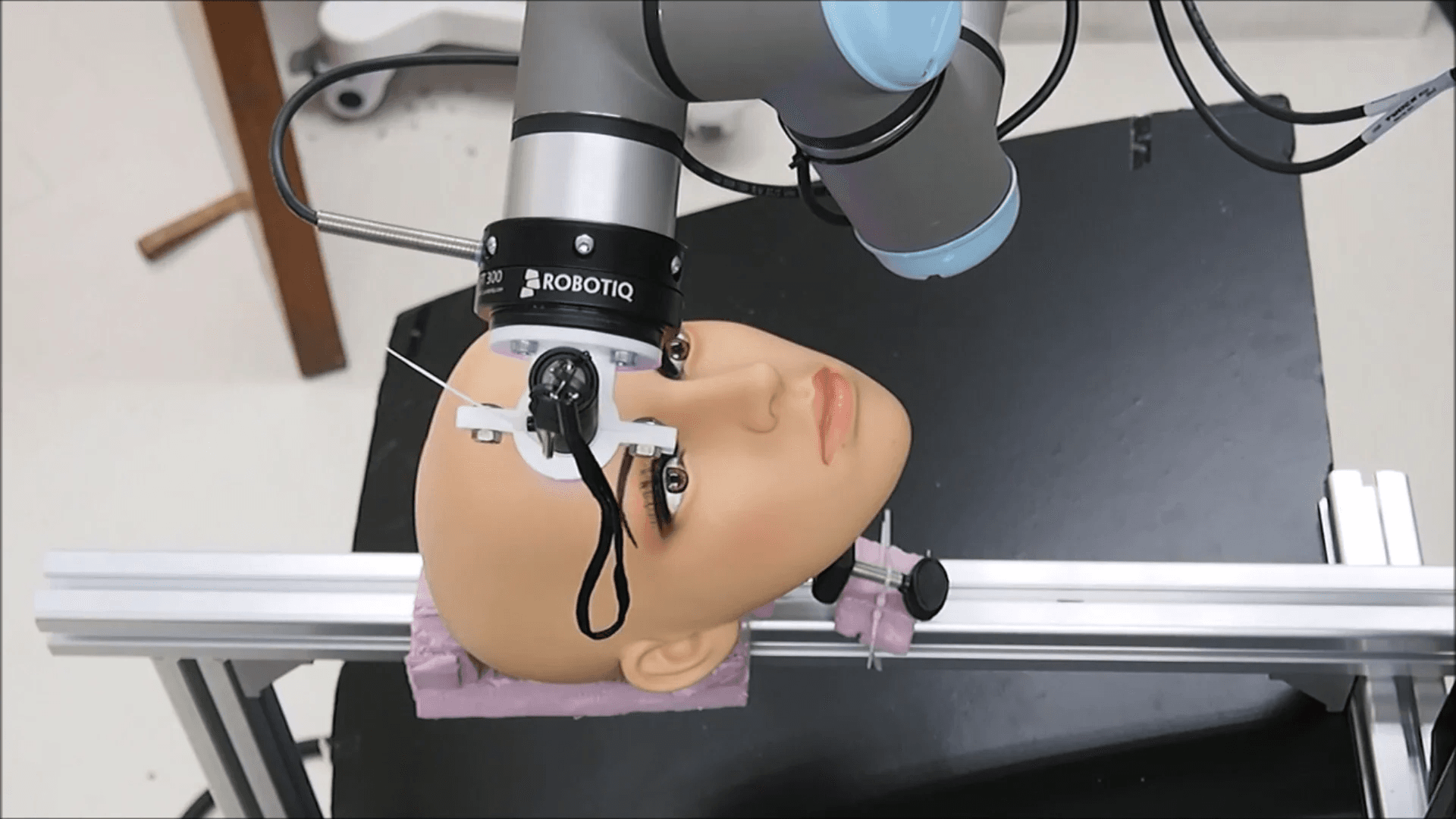 DermaScan — AI Skin Disease Classification