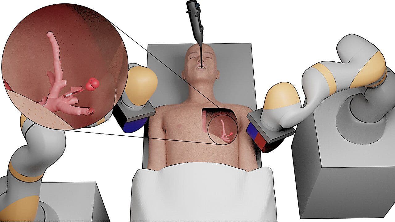 OncoVision — Cancer Residual Detection System