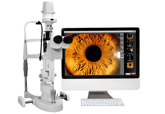 VisionSlit — Computer Vision Integrated Slit Lamp